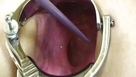 118-year-old Ảnh vuố ...