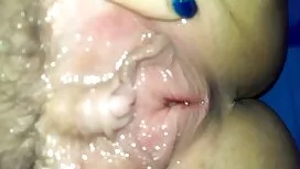 Gầy 18 tuổi, mình co ...